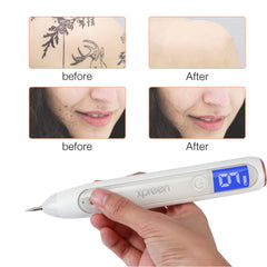 Skin Tag Remover Pen, Mole Wart Remover Pen, Dark Spot Remover, Boho Beauty Gadgets